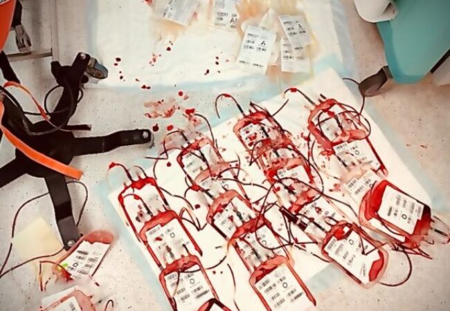 20 מנות דם מתוך 50 שניתנו לאחד הפצועים בחדר הניתוח.