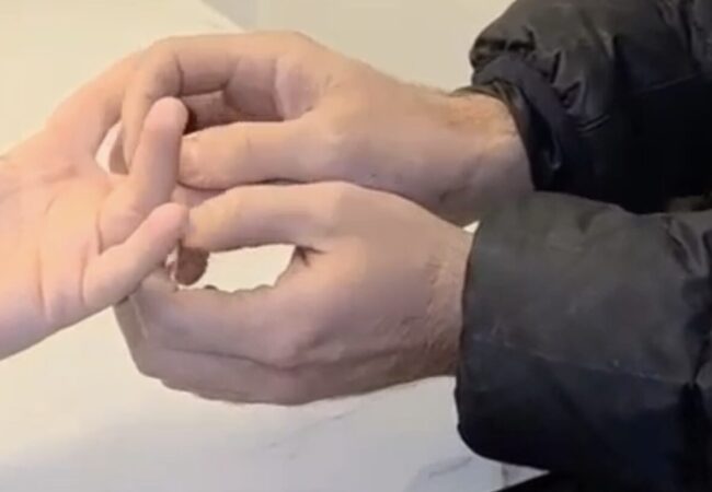 חילוץ הטבעת